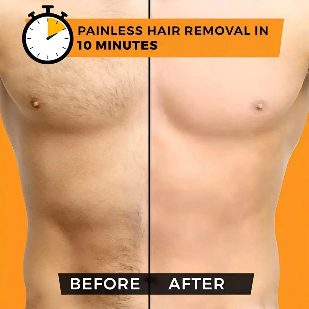 Sydonic hair Removal Treatment